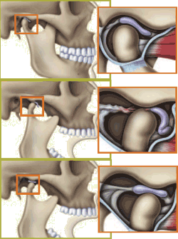 artroscopie